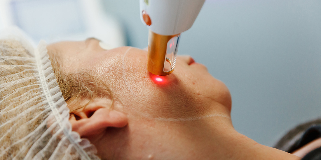 Is lasertherapie ook hetgeen waar je naar op zoek bent?